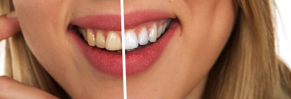 Common Dental Health Myths Debunked